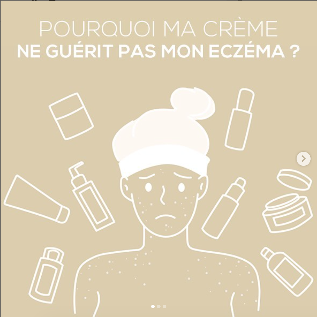 Pourquoi ma crème ne guérit pas mon eczéma